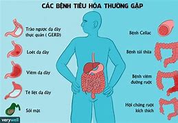 Bệnh táo bón vầ dấu hiệu nhận biết và cách khắc phục